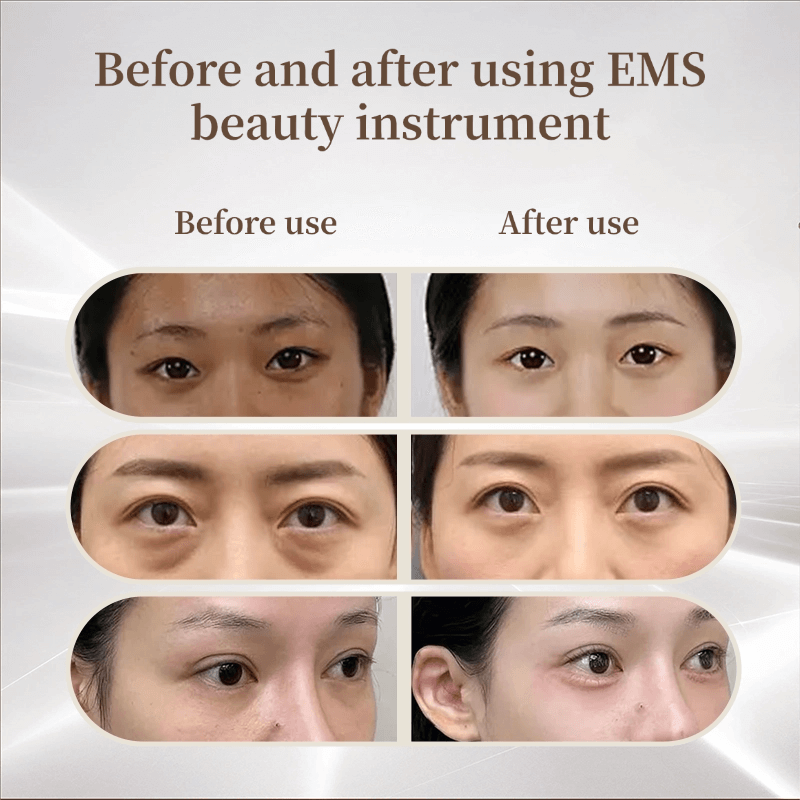 Microcurrent Beauty Instrument Set 7